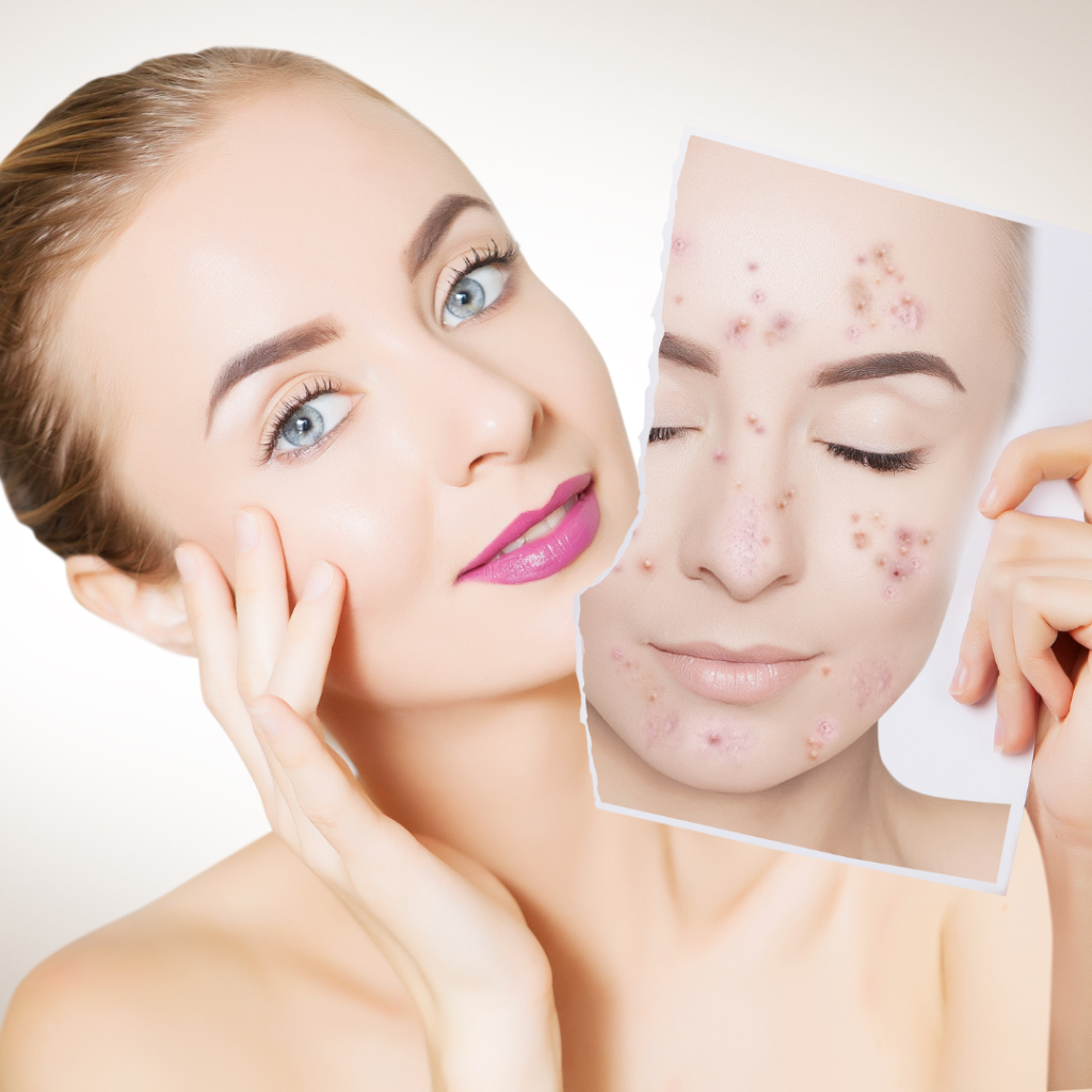 Best Laser Resurfacing Results in Frederick Maryland