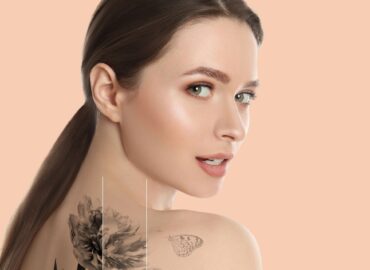 What You Really Need to Know About Permanent Tattoo Removal in Frederick, Maryland