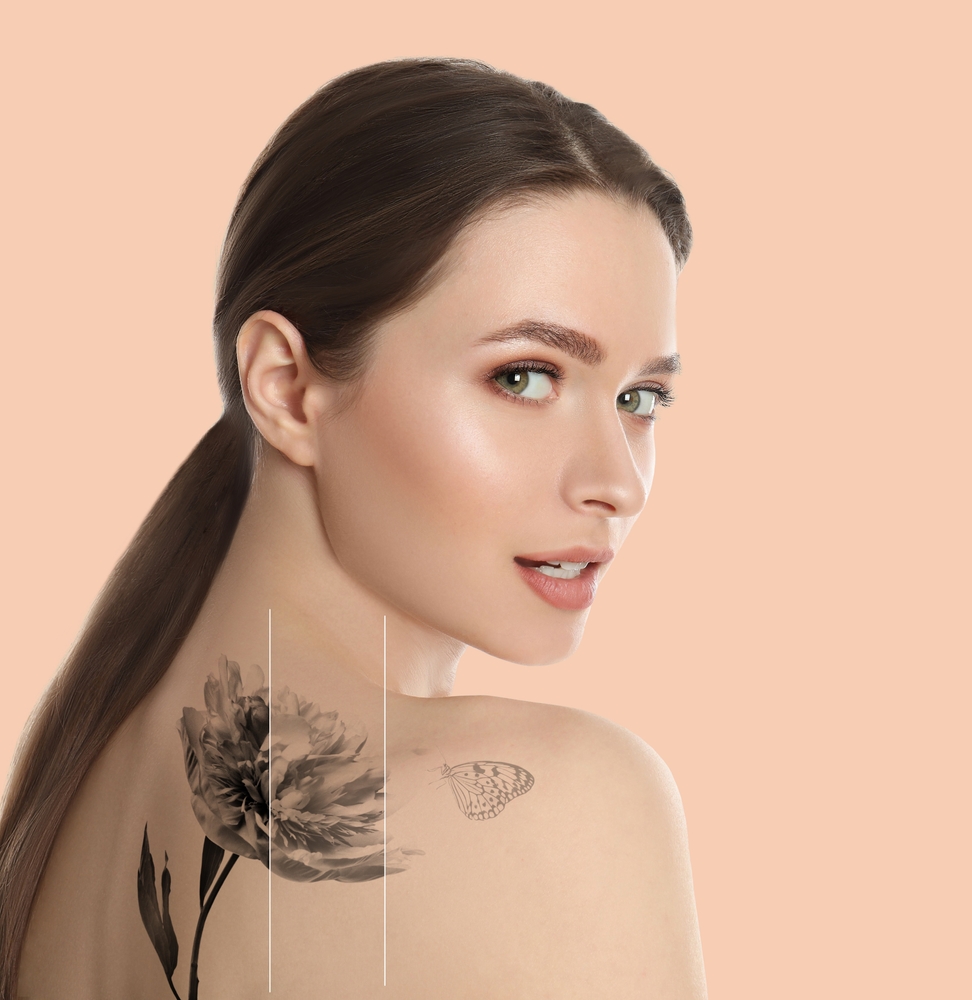 What You Really Need to Know About Permanent Tattoo Removal in Frederick, Maryland