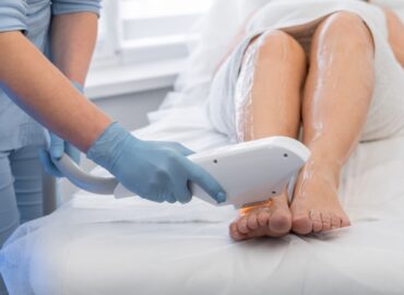 Why Now Is the Time to Get Permanent Laser Hair Removal Near Winchester, Virginia