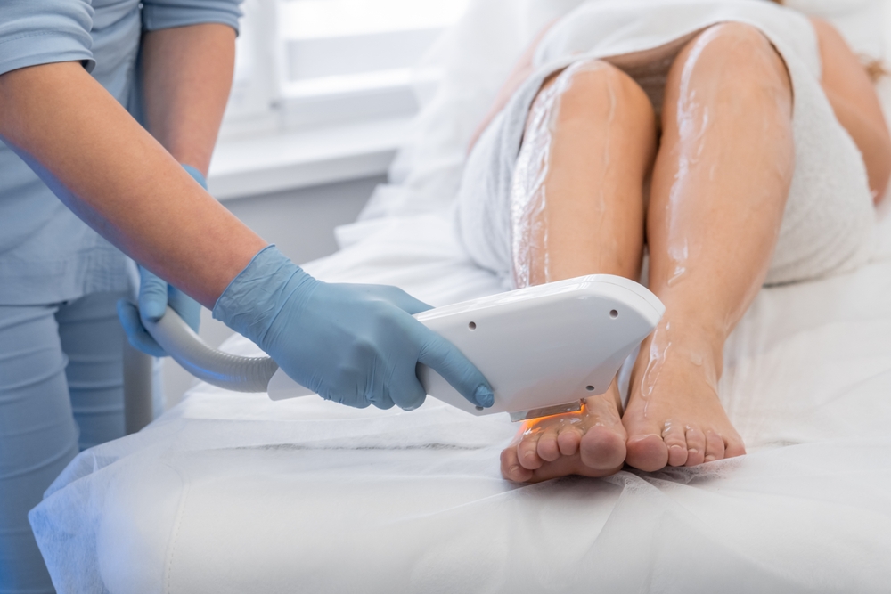 Why Now Is the Time to Get Permanent Laser Hair Removal in Winchester, Virginia