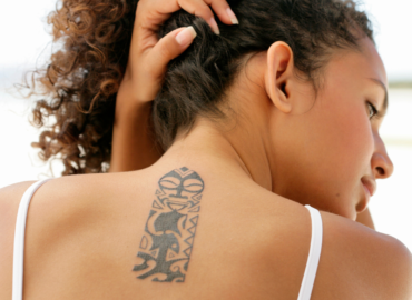 How Much Does Tattoo Removal Cost in Winchester, VA?