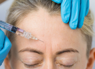 How to Prepare for Same-Day Botox Near Frederick and What to Expect