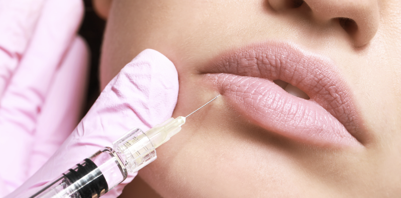 Best Lip Filler Results Near Winchester, Virginia