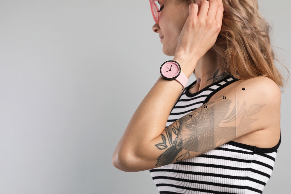 Laser Tattoo Removal Near Waynesboro Pennsylvania